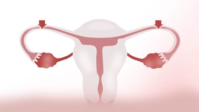 Pregnancy After Tubal Reversal Illinois Midwest Fertility Center’s Expertise
