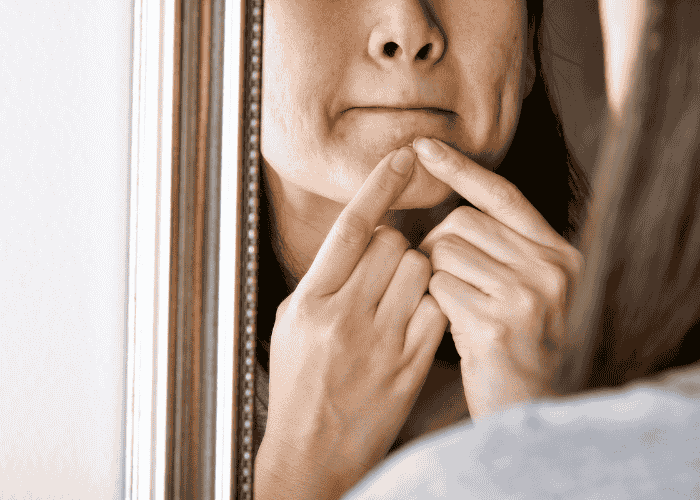 ADHD and Skin Picking: Understanding Causes, Treatments, and Practical Strategies